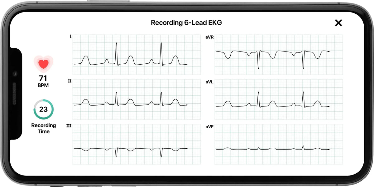 KardiaMobile 6L Personal EKG Monitor with Most Smartphones
